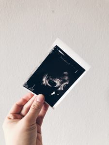 Fehlgeburt | MIssed Abortion in SSW 11 | Daily Malina